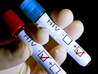 Само деветима са се тествали за СПИН в кабинета на РЗИ-Плевен
