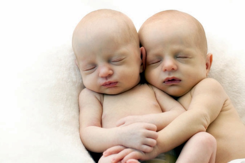 90 двойки близнаци са се родили през 2014-а в УМБАЛ – Плевен