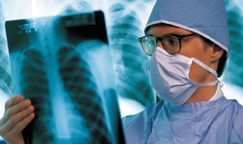 Нови три случая на болни от туберкулоза в област Плевен, 10 са заразените с варицела