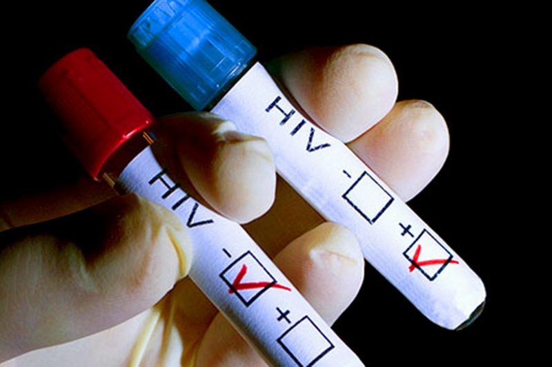 13 се тестваха за СПИН в кабинета на РЗИ-Плевен