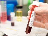 75 се тестваха за СПИН в кабинета на РЗИ – Плевен