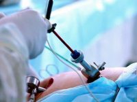 Млади лекари от УМБАЛ – Плевен завършиха курс по лапароскопска хирургия във Франция