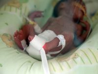 Болниците в Плевен получиха дарение на пелени за недоносени бебета