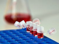 Нови случаи на вирусен хепатит са регистрирани в Плевенско