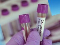 8 съмнителни проби за коронавирус от Плевен и Габрово