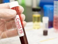 201 пациенти с положителни проби за коронавирус бяха регистрирани през последните 24 часа