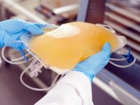 Съветниците ще гласуват предложение за дарение от Община Плевен за доставка на апаратура за извличане на кръвна плазма