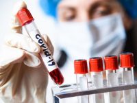 3146 нови случая на заразяване с коронавирус, в област Плевен – 100!