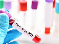 2426 нови заразени с коронавирус, в област Плевен – 116!