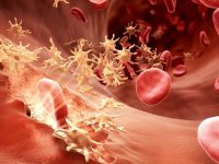 17 април – Световен ден на хемофилията
