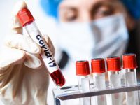 222 нови случая на заразяване с коронавирус, в област Плевен – 4.