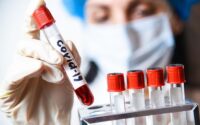 123 са новите случаи на коронавирус, в област Плевен – 2.