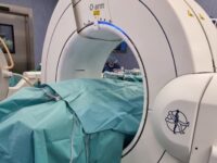 Нова най-висок клас технология при операция на гръбначен стълб прилагат в ,Сърце и Мозък’ Плевен