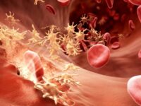 17 април – Световен ден на хемофилията